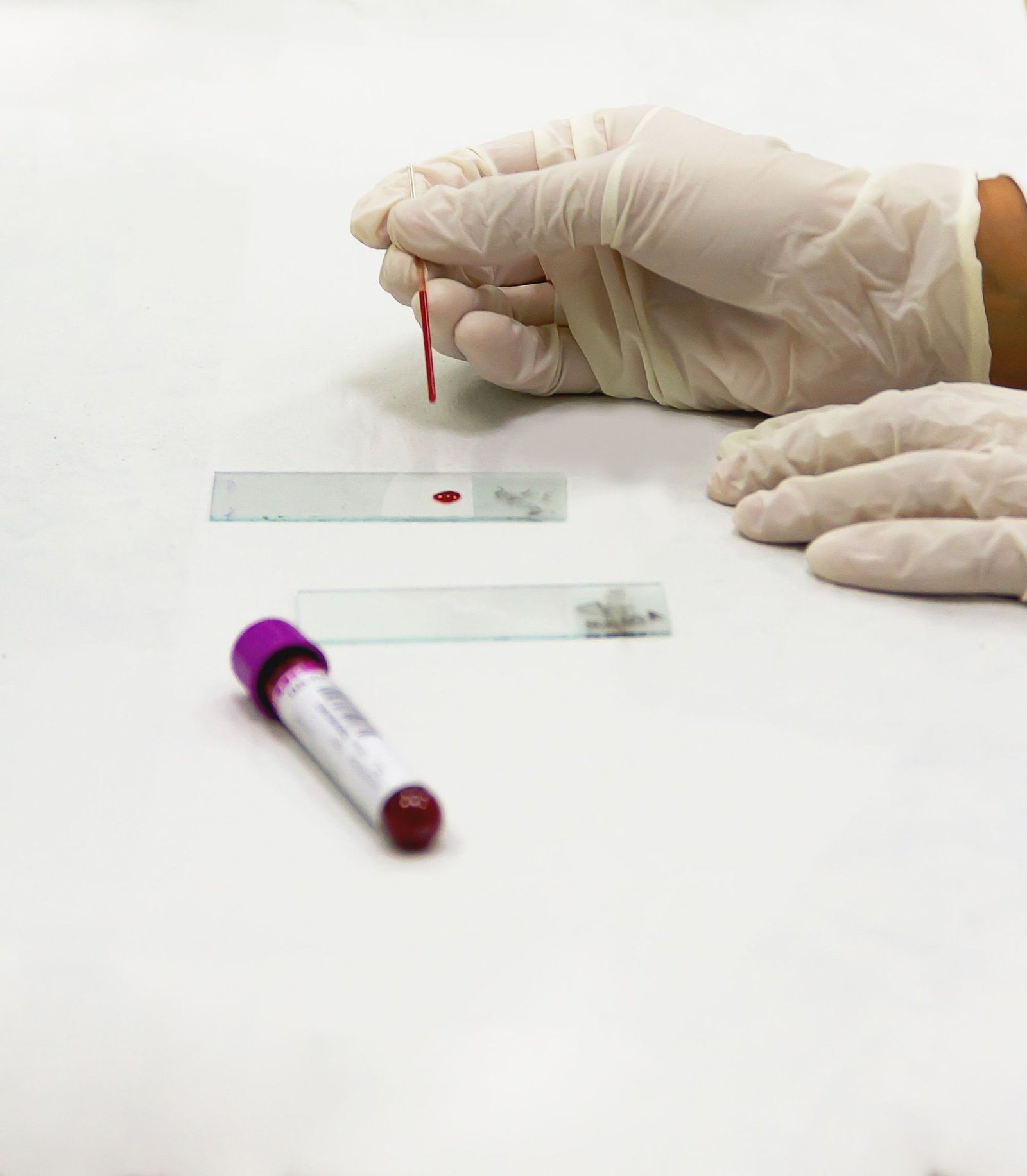 Technologist preparing a blood slide